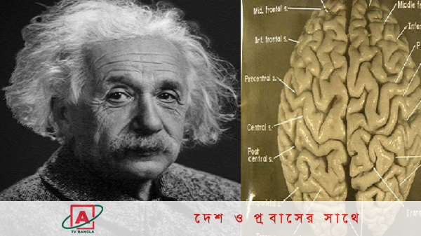 কীভাবে হলো আইনস্টাইনের মস্তিষ্ক চুরি!